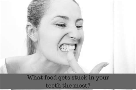 Curious Minds Want To Know What Food Gets Stuck In Your Teeth The Most