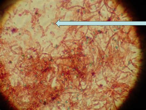 Lab Practical 1 Stain Diagram Quizlet