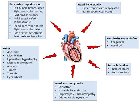 Jcm Free Full Text The Interventricular Septum Structure Function