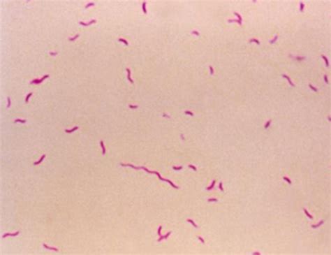 23 Salmonella Campylobacter Pseudomonas Flashcards Quizlet