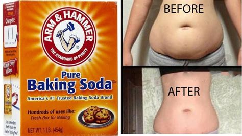 Baking Soda Will Remove All Your Belly Fat With No Exercise Youtube