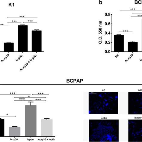 Acrp And Leptin Exert Antagonizing Effects On Papillary Thyroid