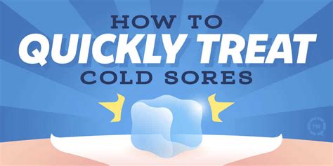 How To Quickly Treat Cold Sores Kent Dentist Seablue Dental