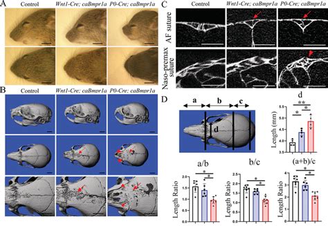 Skull Deformities Of Wnt1‐crecabmpr1a And P0‐crecabmpr1a Mice A