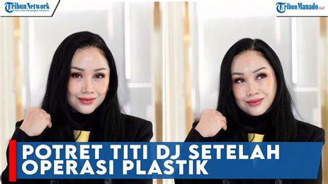 Potret Titi DJ Setelah Operasi Plastik Di Korea Selatan YouTube