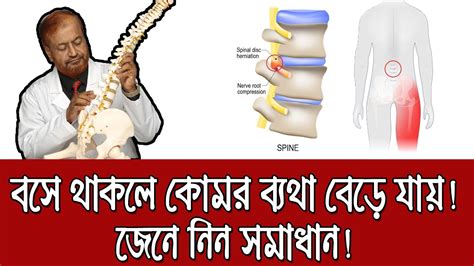 বসলে ব্যথা বেড়ে যায় জেনে নিন সমাধান Back Pain Treatment Youtube