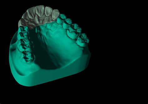 Fichier Stl Mod Le Dentaire Fant Me Pour Les Techniciens Dentaires