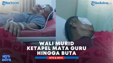 Tak Terima Anaknya Ditegur Wali Murid Ketapel Mata Guru Hingga Buta