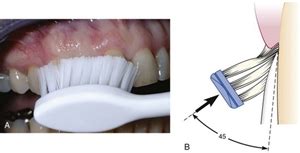 Tooth Brushing Techniques | News | Dentagama