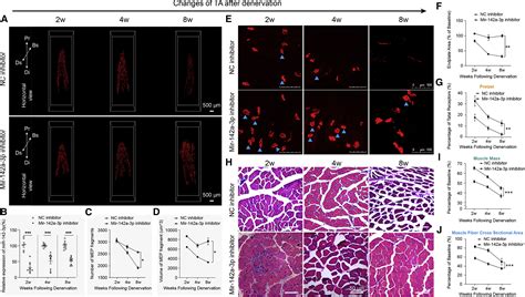 Mir A P A Novel Ach Receptor Transcriptional Regulator In