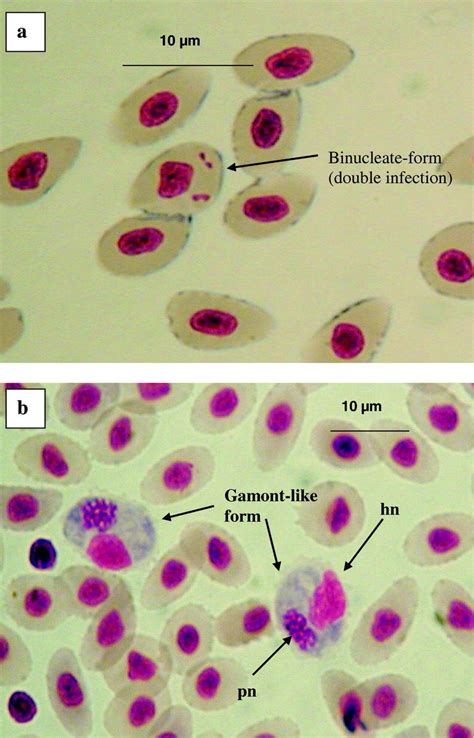 Prevalence And Spatial Distribution Of Intraerythrocytic Parasites In