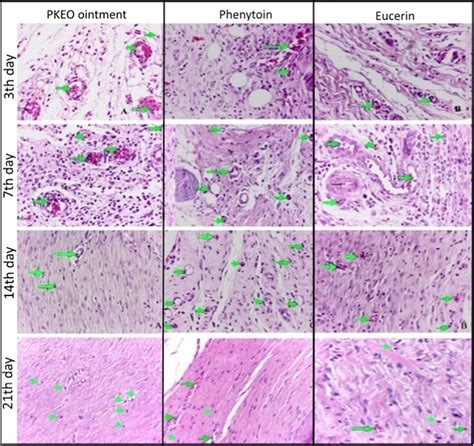 Angiogenesis Process In Wound Location After Treatment With PKEOs