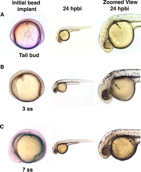 Microbead Implantation In The Zebrafish Embryo Video JoVE Protocol