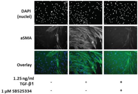 Fibroblast To Myofibroblast Transition Fmt Assay Charles River