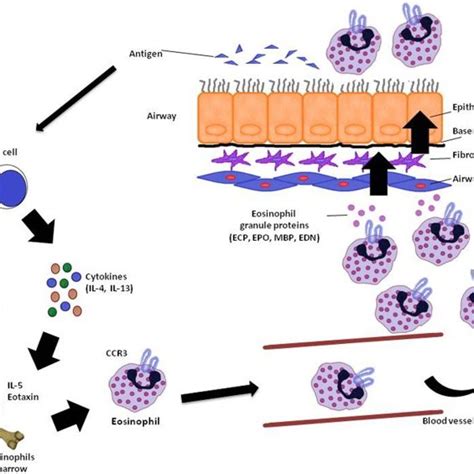 Eosinophil Recruitment In Asthma In The Reaction Of The Airway To