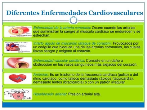 Enfemedades Cardiovasculares Clasificacion De Las Enfermedades