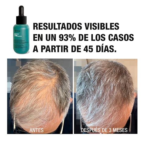 PEPTIDE T98 Densificante capilar estimulador folicular y anticaída