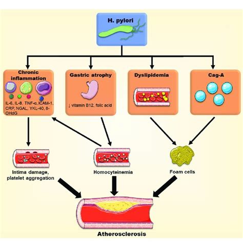 Different Pathways Through Which H Pylori May Promote Atherosclerotic