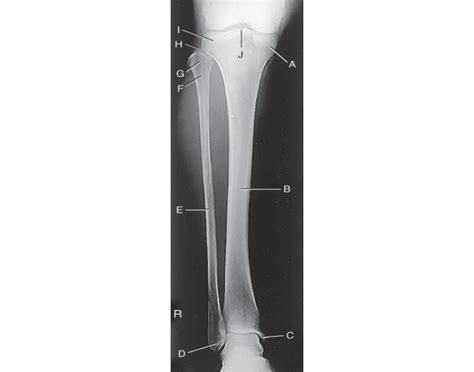 AP tib-fib anatomy review Quiz