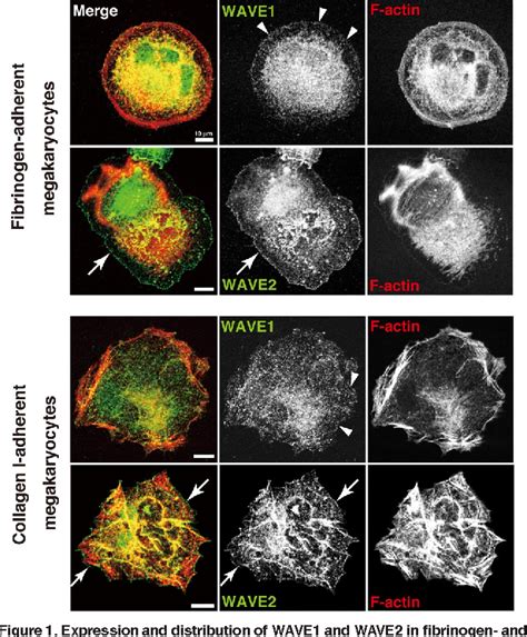 Figure 1 From The Wave2abi1 Complex Differentially Regulates