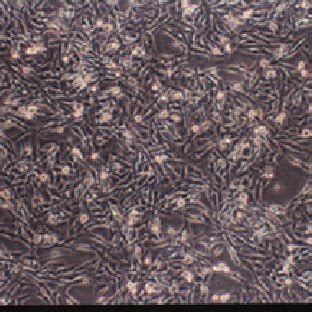 The Human Malignant Glioma Cells U Mg Growing In Vitro