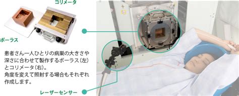 陽子線治療の流れ｜陽子線治療をお考えの方へ 筑波大学附属病院 陽子線治療センター