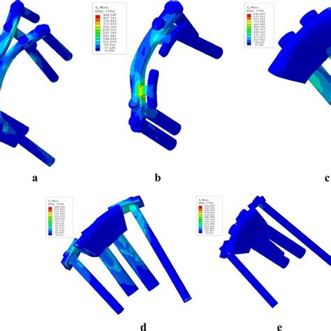 Stress Distribution Of Each Plate Screw Or Prosthesis Screw Model At Download Scientific