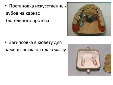 Полимерные материалы в ортопедической стоматологии - презентация онлайн