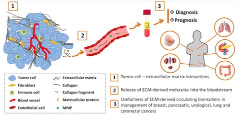 Cells Free Full Text Tumor Extracellular Matrix Remodeling New