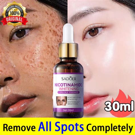 Dark Spot Whitening And Freckle Removing Essence 30ML Niacinamide Serum