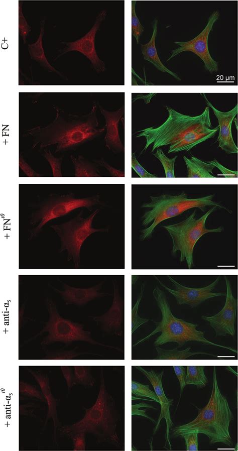 Cytoskeleton organization and focal adhesion formation on 2D (C+) and ... 
