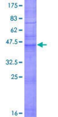 Recombinant Human Claudin Gst N Term Protein H P Novus