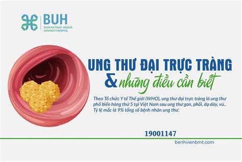 UNG THƯ ĐẠI TRỰC TRÀNG - BUH