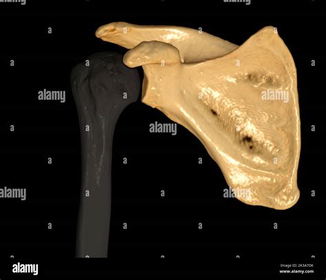 Ct Shoulder D Of Computed Tomography Volume Rendering Examination Of