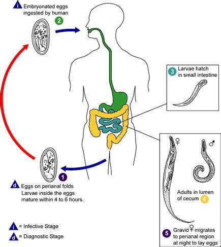 Threadworm Enterobius Vermicularis - Lone Parenting