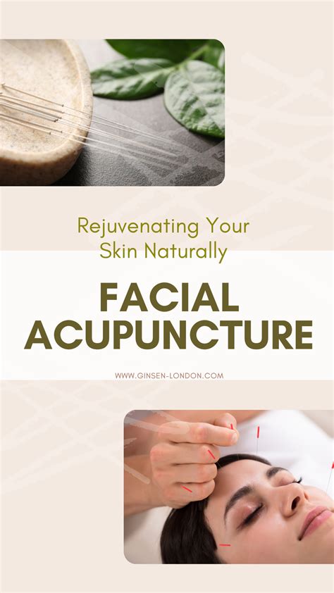 Facial Acupuncture Benefits How Does It Work Artofit