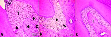 A Photomicrograph Of Group I Showing A Gingival Transseptal T