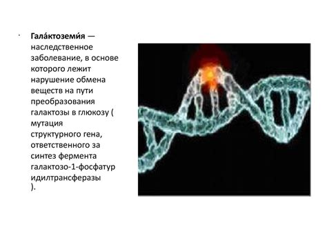 Галактоземия. Клиника - online presentation