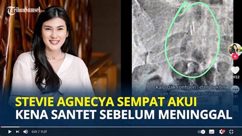 Terekam Kamera Benda Misterius Diduga Santet Bersarang Di Tubuh