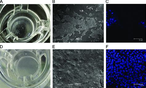 Effect Of Basement Membrane On Caco Culture A C Serum Free