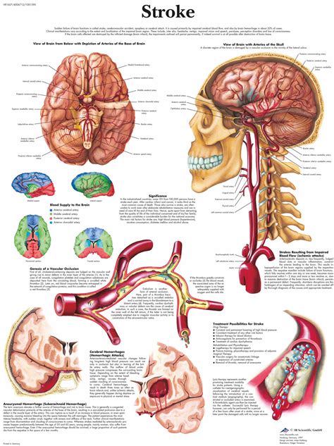 Hugo Chrost On Twitter The Anatomy Of Stroke Source 3bscientific