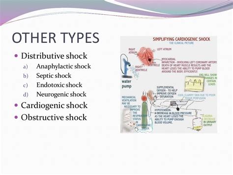 Circulatory Shock