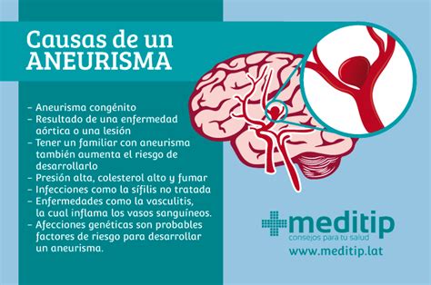 Aneurisma Que Es Sintomas Causas Y Tratamiento