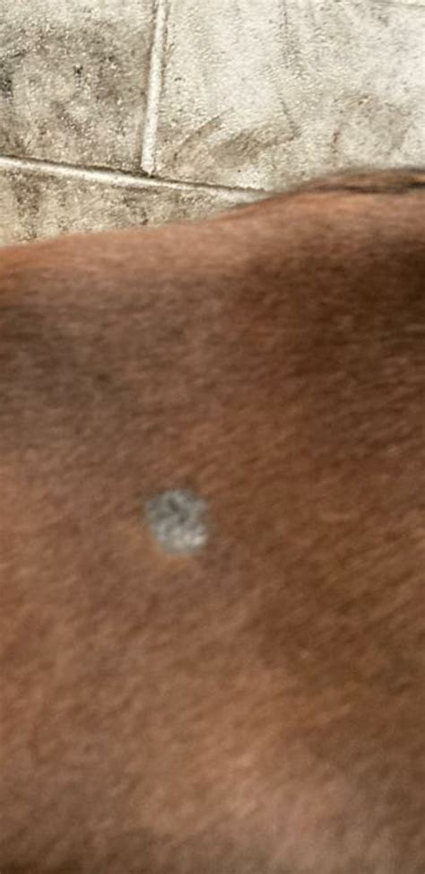 Ringworm The Horse Forum