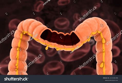 Anatomy Human Colon Cross Section 3d Stock Illustration 2172391789