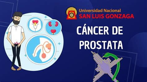 Cáncer De Próstata Dragarcia Gutierrez Julia G Udocz