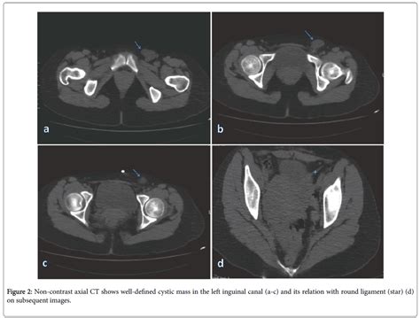 Radiology Axial Ct