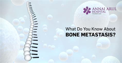 WHAT DO YOU KNOW ABOUT BONE METASTASIS? – Multispeciality Hospitals in Chennai