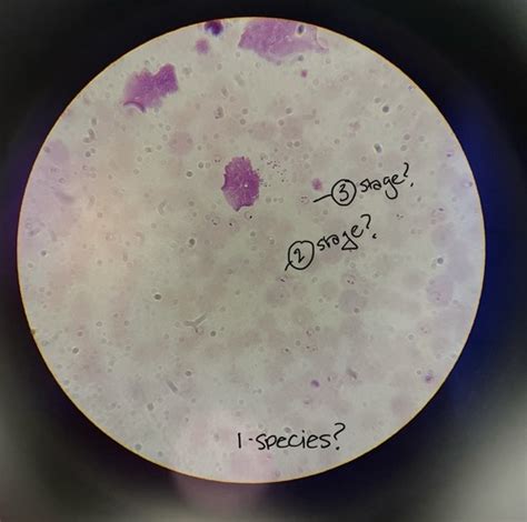 Parasitology Lab Exam 3 The Unicellular Eukaryotes Flashcards Quizlet