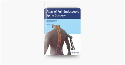 Atlas Of Full Endoscopic Spine Surgery By Christoph P Hofstetter